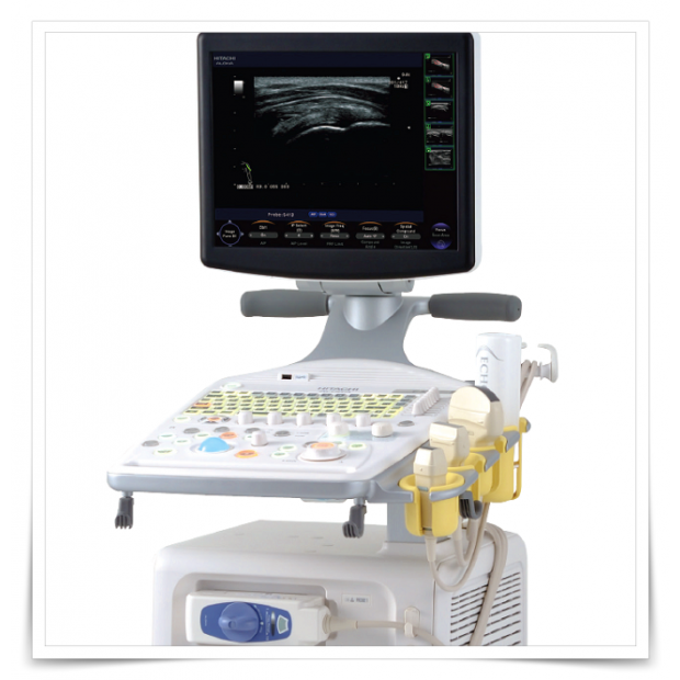 HITACHI Aloka F37彩色超音波